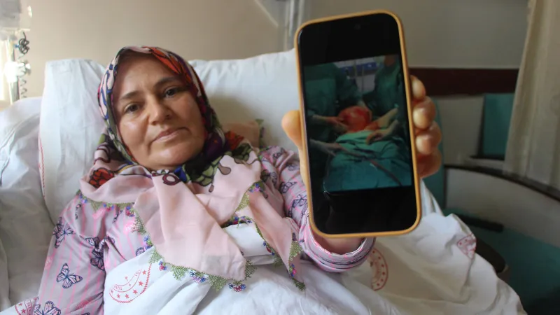 Karnı 9 aylık hamile gibi şişti, nefes darlığıyla hastaneye koştu, aldığı haber karşısında şaşkına döndü: Tam 8 buçuk kilogram!